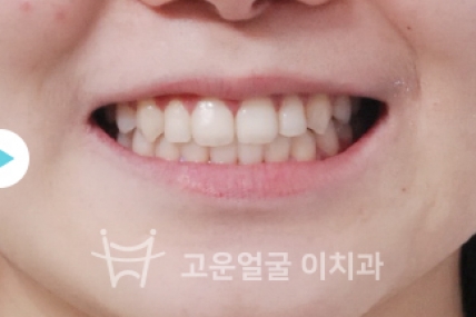 치료사례